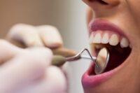 Receita define percentuais de presunção para serviços odontológicos e procedimentos cirúrgicos no lucro presumido